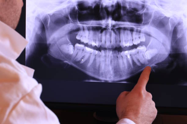 Best Weekend Emergency Dentist in Decatur, MI