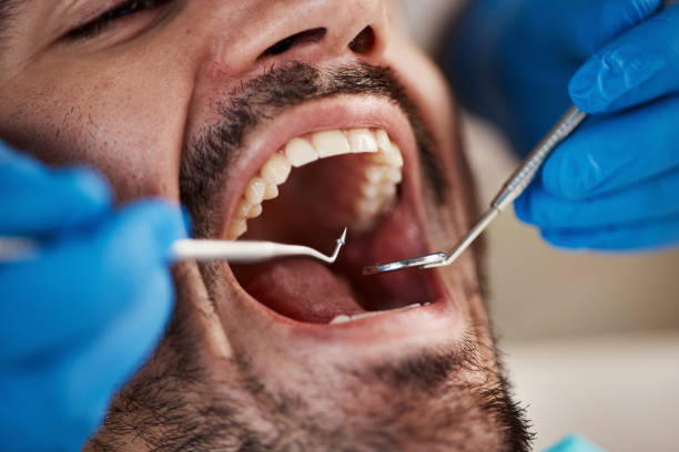 Best Pediatric Emergency Dentist in Decatur, MI