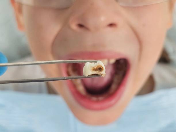 Best Emergency Orthodontic Services in Decatur, MI